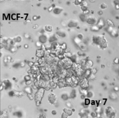 ヒト乳がん細胞（MCF-7）培養例